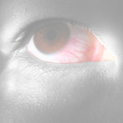GOTAS PARA OJOS SECOS